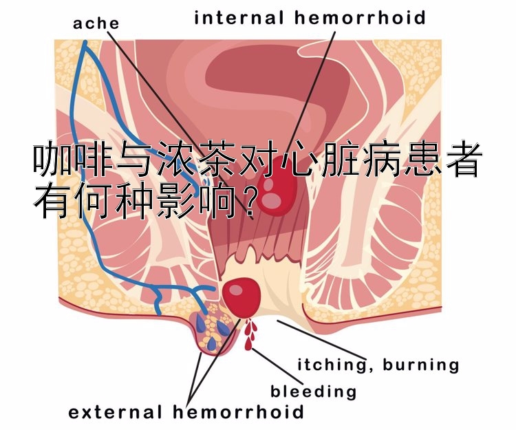 咖啡与浓茶对心脏病患者有何种影响？