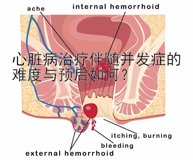 心脏病治疗伴随并发症的难度与预后如何？