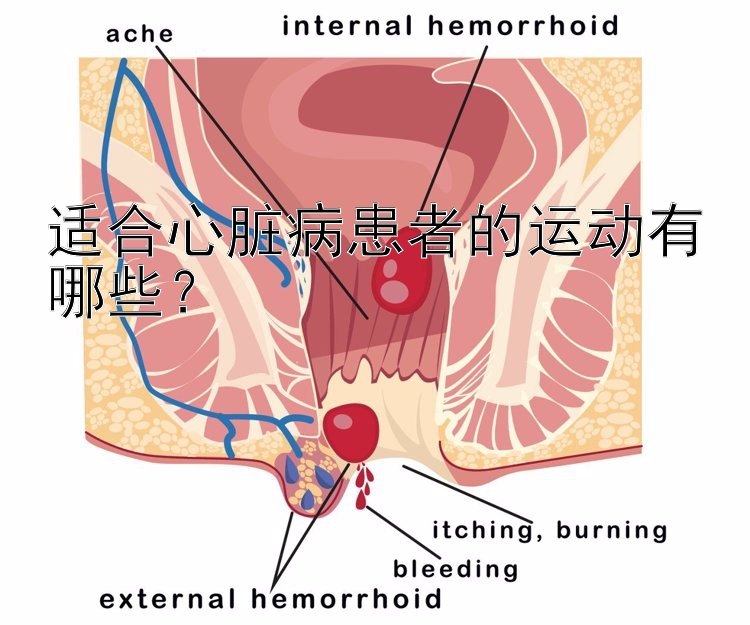 适合心脏病患者的运动有哪些？