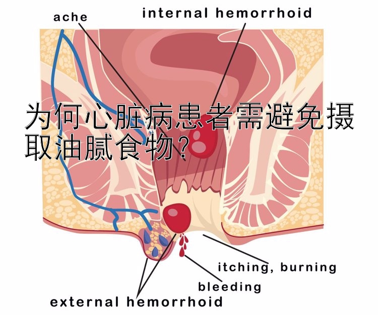 为何心脏病患者需避免摄取油腻食物？