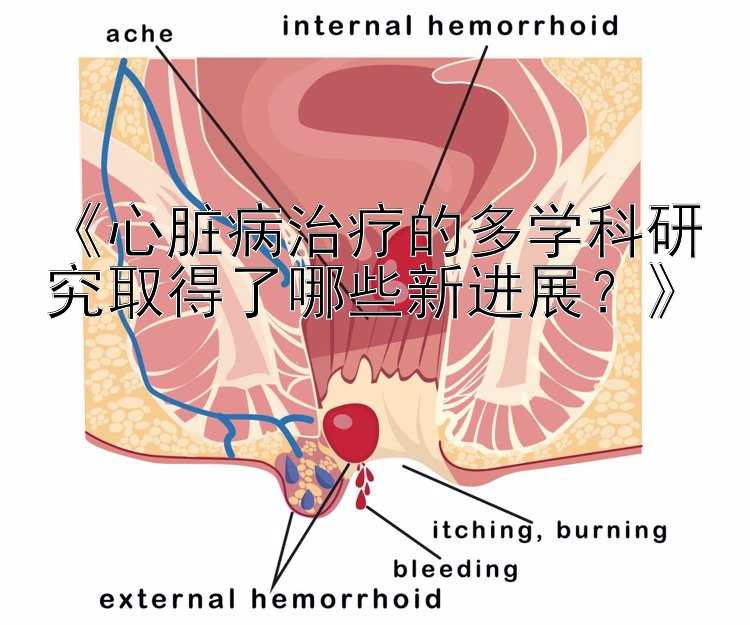 《心脏病治疗的多学科研究取得了哪些新进展？》