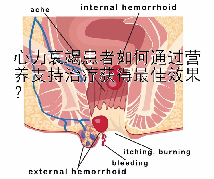 心力衰竭患者如何通过营养支持治疗获得最佳效果？