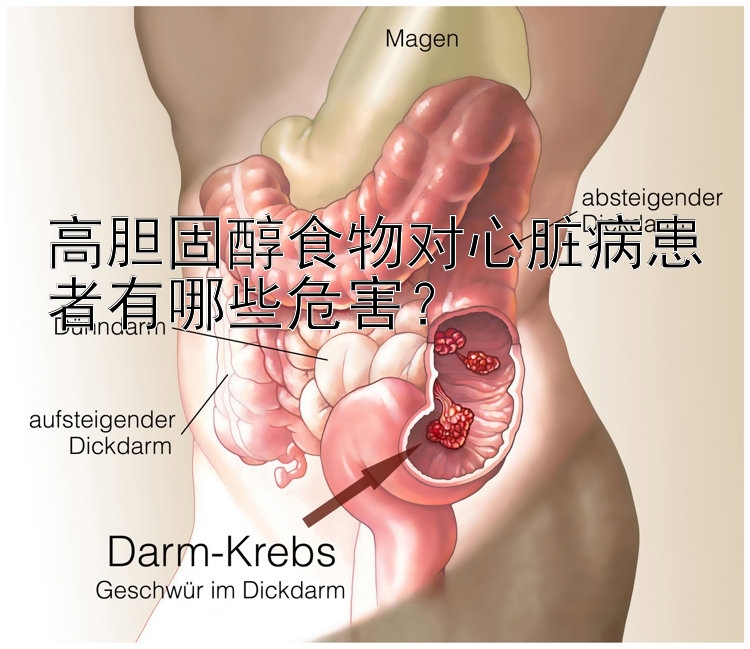 高胆固醇食物对心脏病患者有哪些危害？