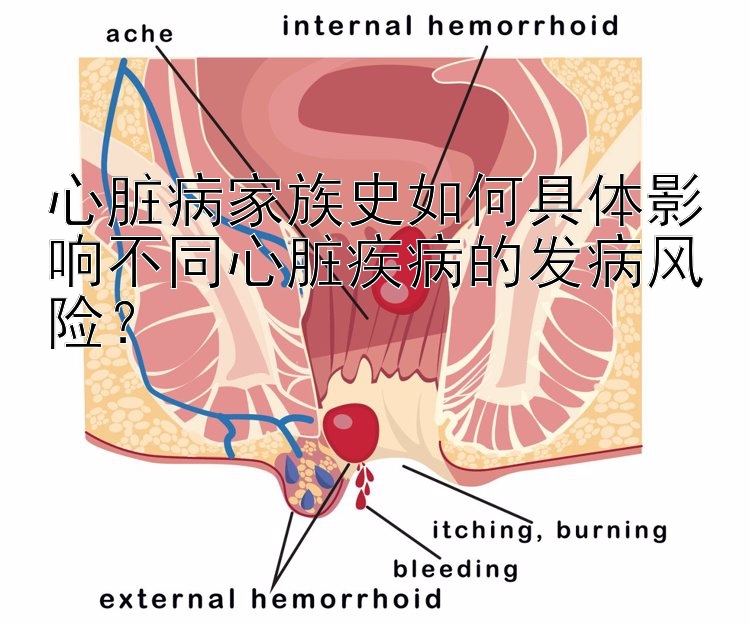 心脏病家族史如何具体影响不同心脏疾病的发病风险？