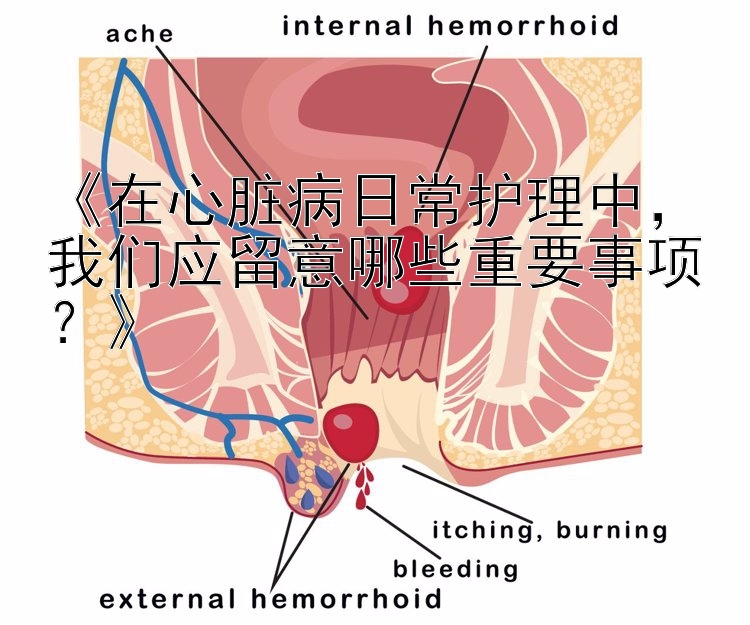 《在心脏病日常护理中，我们应留意哪些重要事项？》