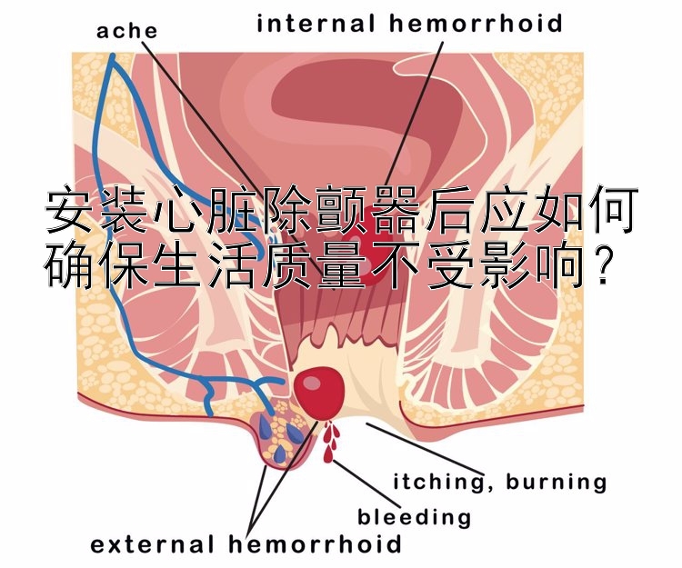 安装心脏除颤器后应如何确保生活质量不受影响？