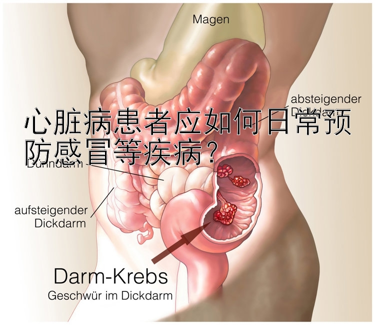 心脏病患者应如何日常预防感冒等疾病？