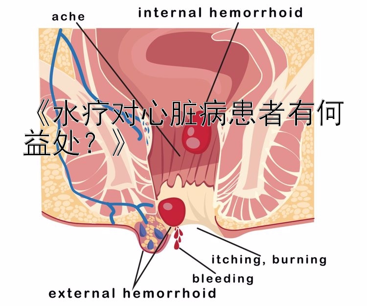 《水疗对心脏病患者有何益处？》