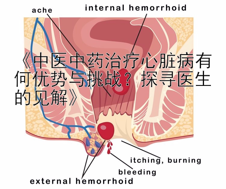 《中医中药治疗心脏病有何优势与挑战？探寻医生的见解》