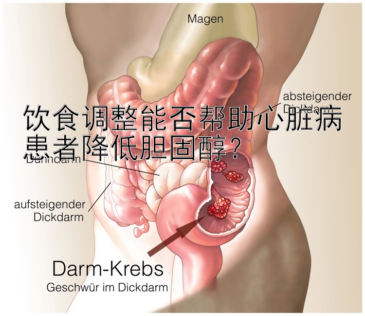 饮食调整能否帮助心脏病患者降低胆固醇？