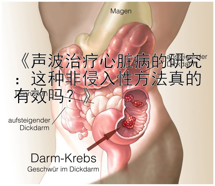 《声波治疗心脏病的研究：这种非侵入性方法真的有效吗？》