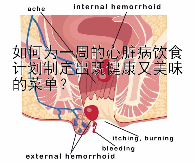 如何为一周的心脏病饮食计划制定出既健康又美味的菜单？