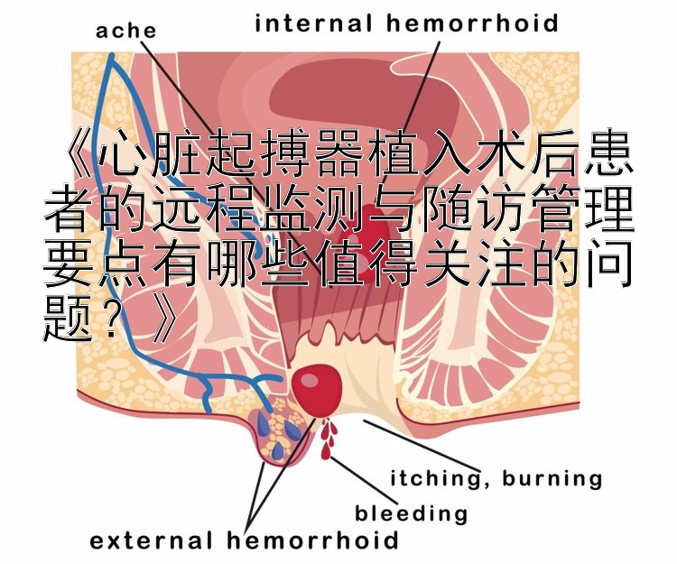 《心脏起搏器植入术后患者的远程监测与随访管理要点有哪些值得关注的问题？》